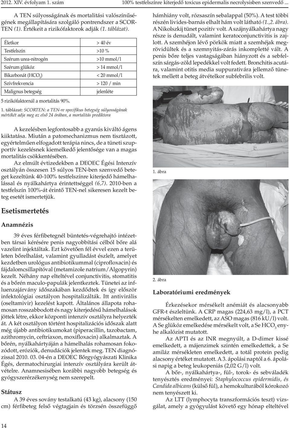 Életkor > 40 év Testfelszín >10 % Szérum urea-nitrogén >10 mmol/l Szérum glükóz > 14 mmol/l Bikarbonát (HCO3) < 20 mmol/l Szívfrekvencia > 120 / min Malignus betegség jelenléte hámhiány volt,