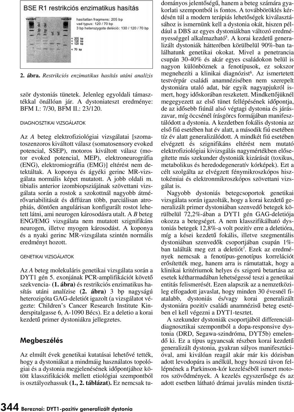 elektroneurográfia (ENG), elektromiográfia (EMG)] eltérést nem detektáltak. A koponya és ágyéki gerinc MR-vizsgálata normális képet mutatott. A jobb oldali m.