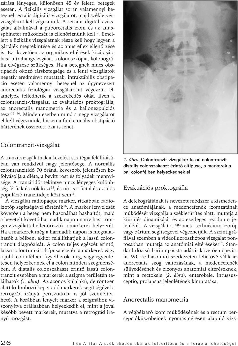 Emellett a fizikális vizsgálatnak része kell hogy legyen a gáttájék megtekintése és az anusreflex ellenôrzése is.