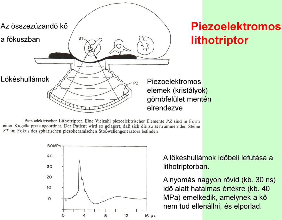 időbeli lefutása a lithotriptorban. nyomás nagyon rövid (kb.