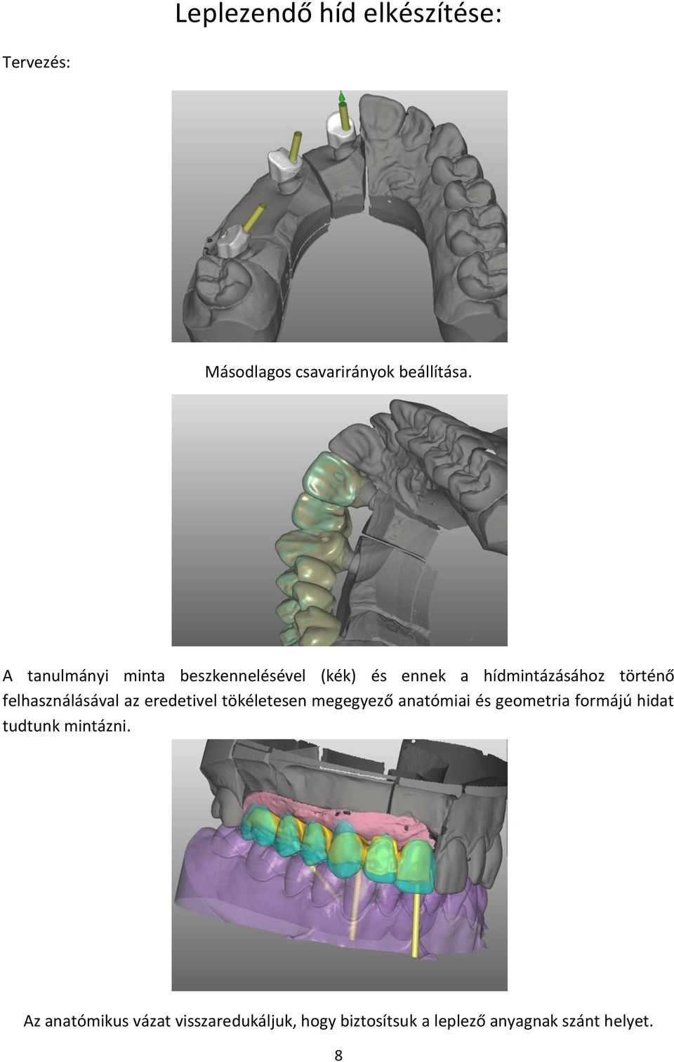 felhasználásával az eredetivel tökéletesen megegyező anatómiai és geometria formájú