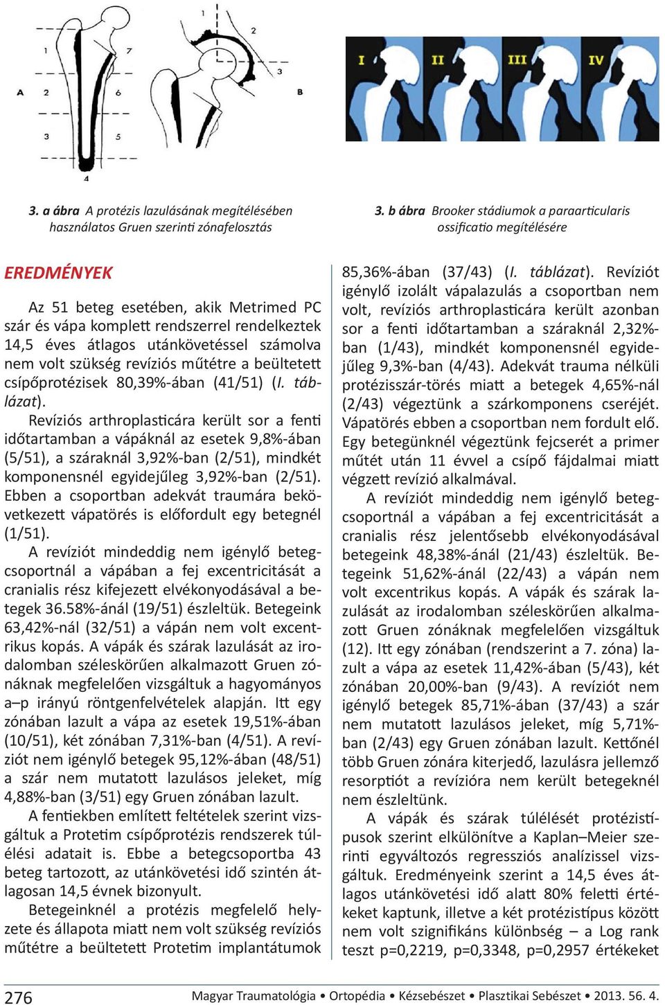 számolva nem volt szükség revíziós műtétre a beültetett csípőprotézisek 80,39%-ában (41/51) (I. táblázat).