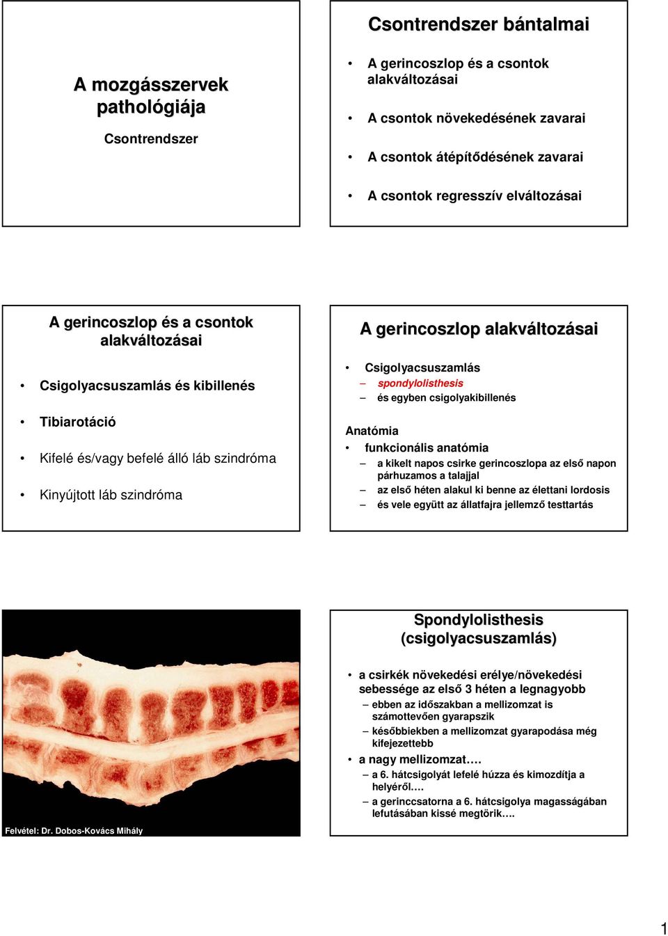 alakváltoz ltozásai Csigolyacsuszamlás spondylolisthesis és egyben csigolyakibillenés Anatómia funkcionális anatómia a kikelt napos csirke gerincoszlopa az elsı napon párhuzamos a talajjal az elsı