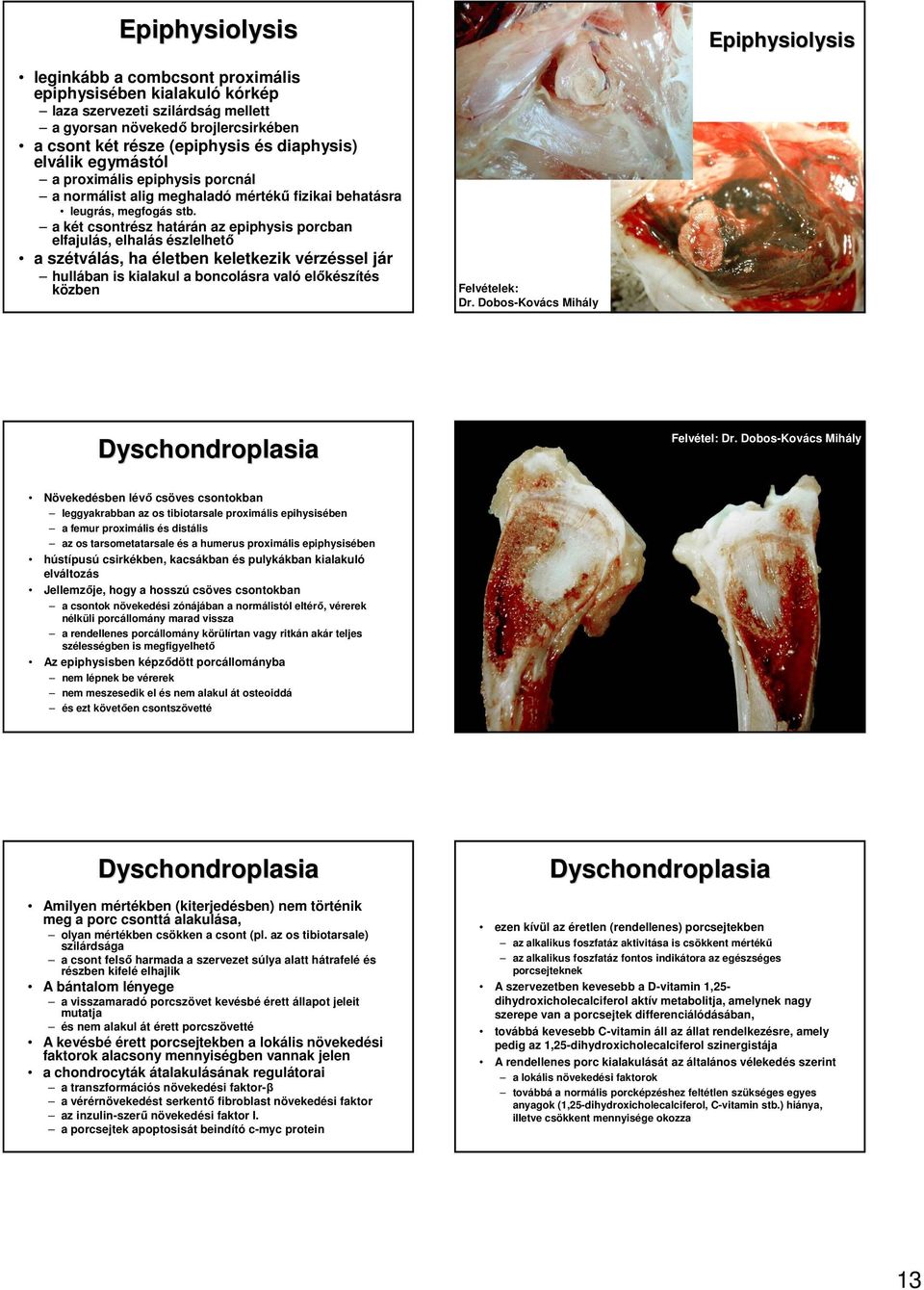 a két csontrész határán az epiphysis porcban elfajulás, elhalás észlelhetı a szétválás, ha életben keletkezik vérzéssel jár hullában is kialakul a boncolásra való elıkészítés közben Felvételek: Dr.