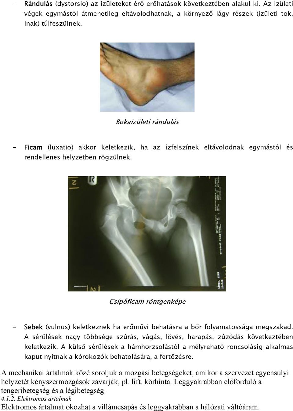 Csípőficam röntgenképe - Sebek (vulnus) keletkeznek ha erőművi behatásra a bőr folyamatossága megszakad. A sérülések nagy többsége szúrás, vágás, lövés, harapás, zúzódás következtében keletkezik.