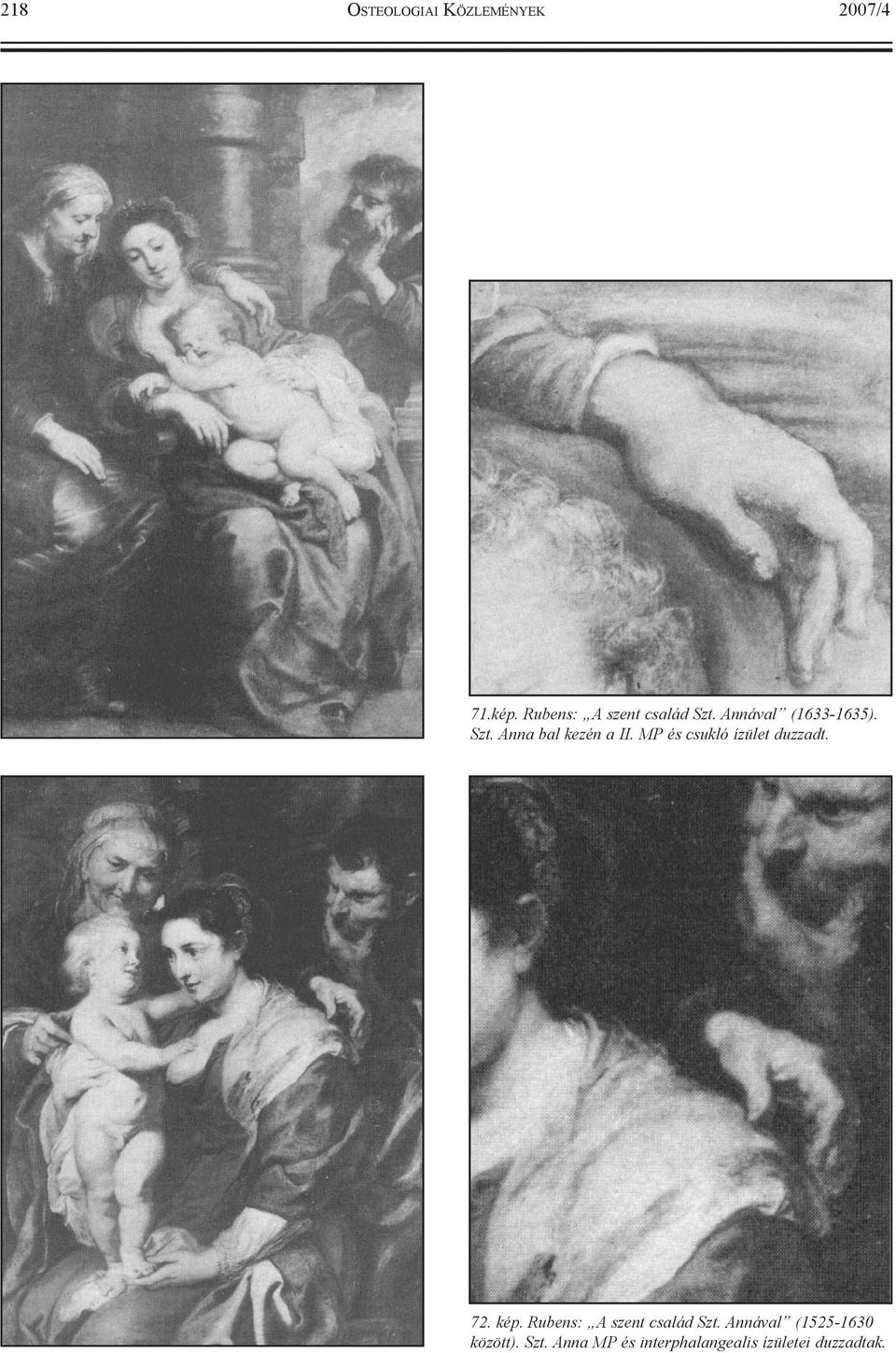 MP és csukló ízület duzzadt. 72. kép. Rubens: A szent család Szt.