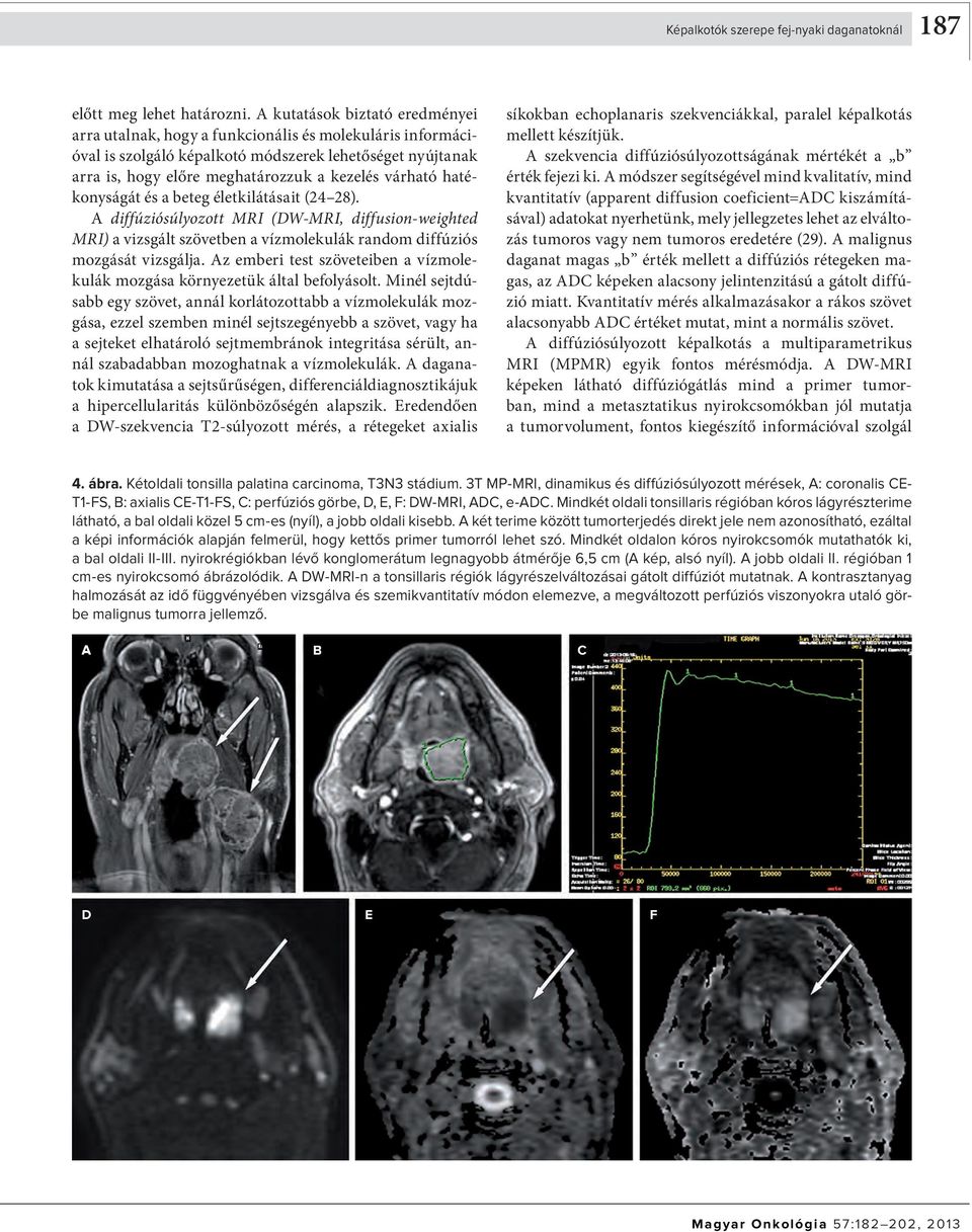 hatékonyságát és a beteg életkilátásait (24 28). diffúziósúlyozott MRI (W-MRI, diffusion-weighted MRI) a vizsgált szövetben a vízmolekulák random diffúziós mozgását vizsgálja.