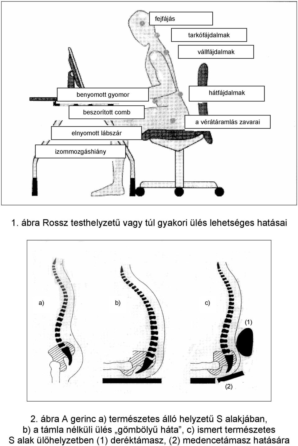 ábra Rossz testhelyzetű vagy túl gyakori ülés lehetséges hatásai a) b) c) (1) (2) 2.