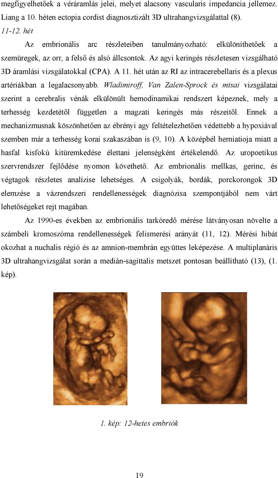 hét után az RI az intracerebellaris és a plexus artériákban a legalacsonyabb.