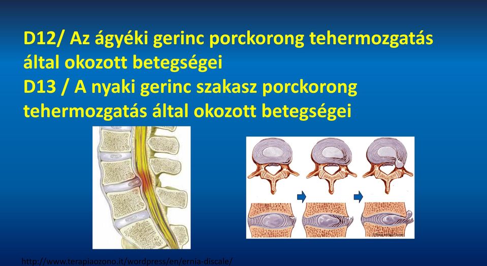 szakasz porckorong tehermozgatás által okozott