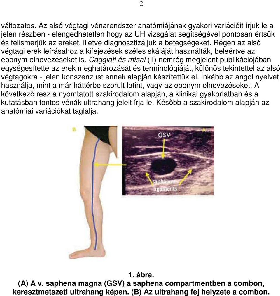 diagnosztizáljuk a betegségeket. Régen az alsó végtagi erek leírásához a kifejezések széles skáláját használták, beleértve az eponym elnevezéseket is.