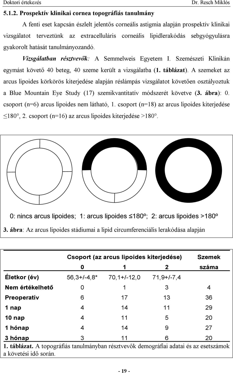 lipidlerakódás sebgyógyulásra gyakorolt hatását tanulmányozandó. Vizsgálatban résztvevők: A Semmelweis Egyetem I. Szemészeti Klinikán egymást követő 40 beteg, 40 szeme került a vizsgálatba (1.