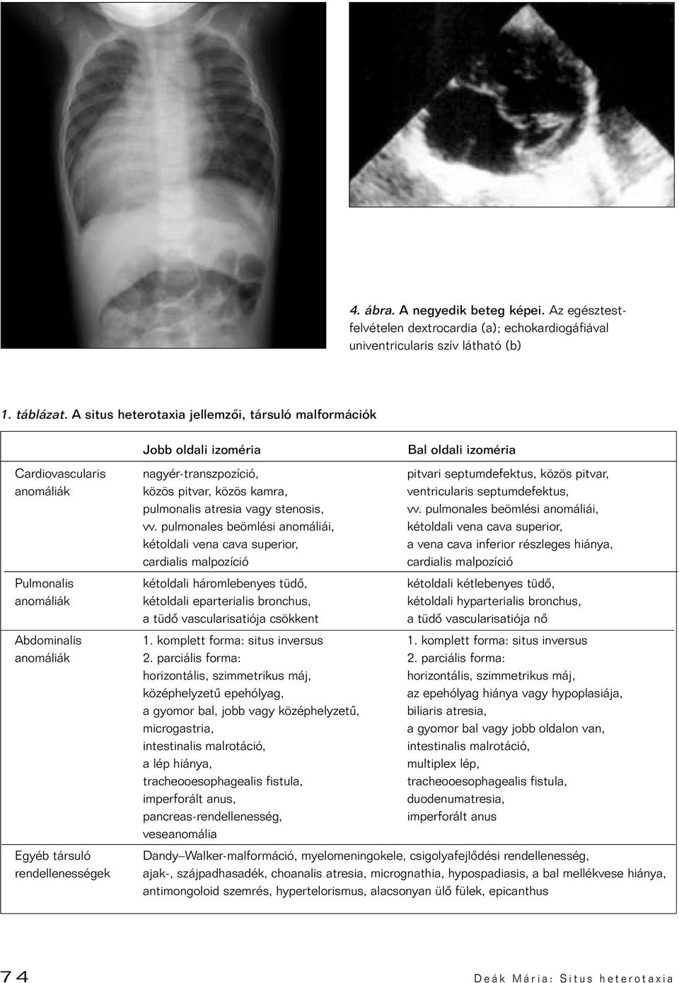 kamra, ventricularis septumdefektus, pulmonalis atresia vagy stenosis, vv. pulmonales beömlési anomáliái, vv.