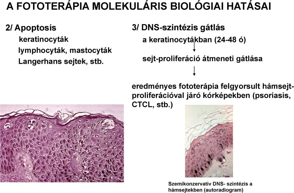 3/ DNS-szintézis gátlás a keratinocytákban (24-48 ó) sejt-proliferáció átmeneti gátlása