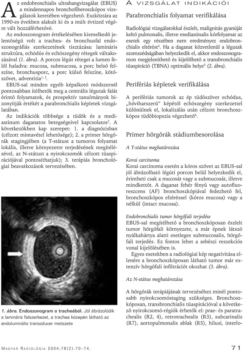 ára). A porcos légút rétegei a lumen felôl haladva: mucosa, sumucosa, a porc elsô felszíne, ronchusporc, a porc külsô felszíne, kötôszövet, adventitia 1, 2.