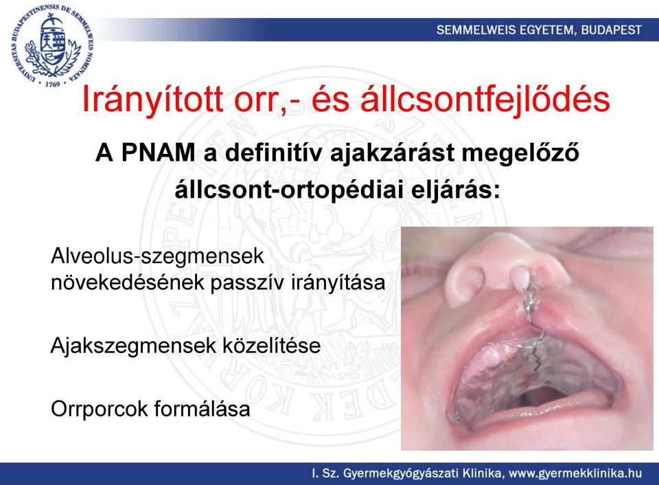 eljárás: Alveolus-szegmensek növekedésének passzív