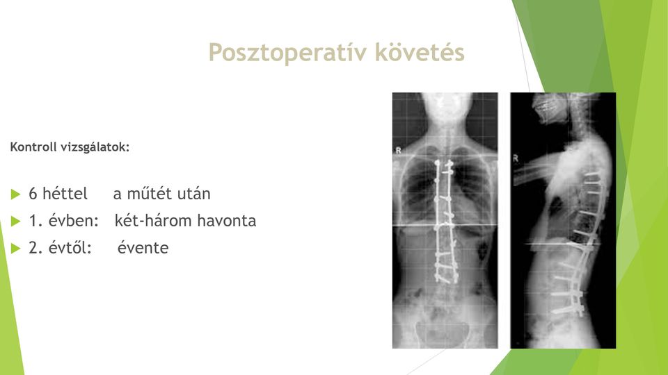 héttel a műtét után 1.