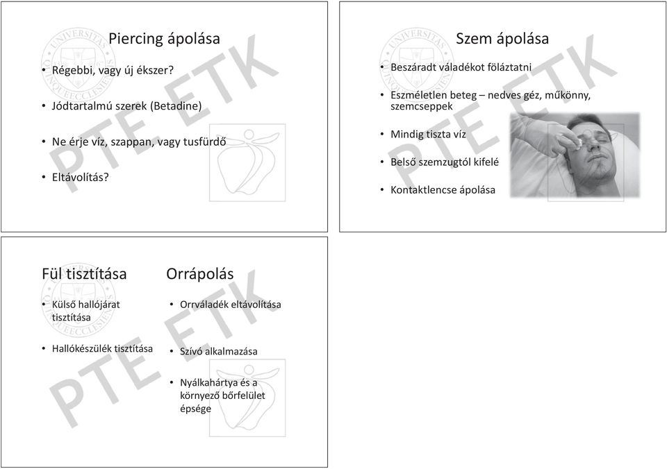 Szem ápolása Beszáradt váladékot föláztatni Eszméletlen beteg nedves géz, m könny, szemcseppek Mindig tiszta