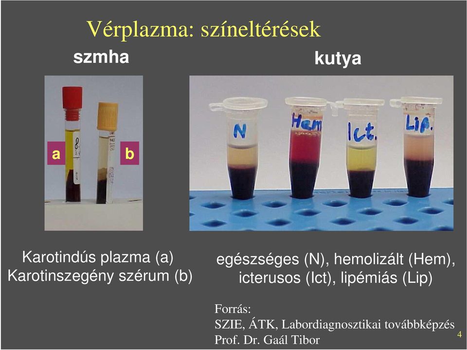 szérum (b) egészséges (N), hemolizált