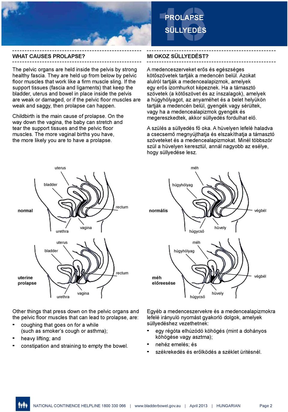 can happen. Childbirth is the main cause of prolapse. On the way down the vagina, the baby can stretch and tear the support tissues and the pelvic floor muscles.