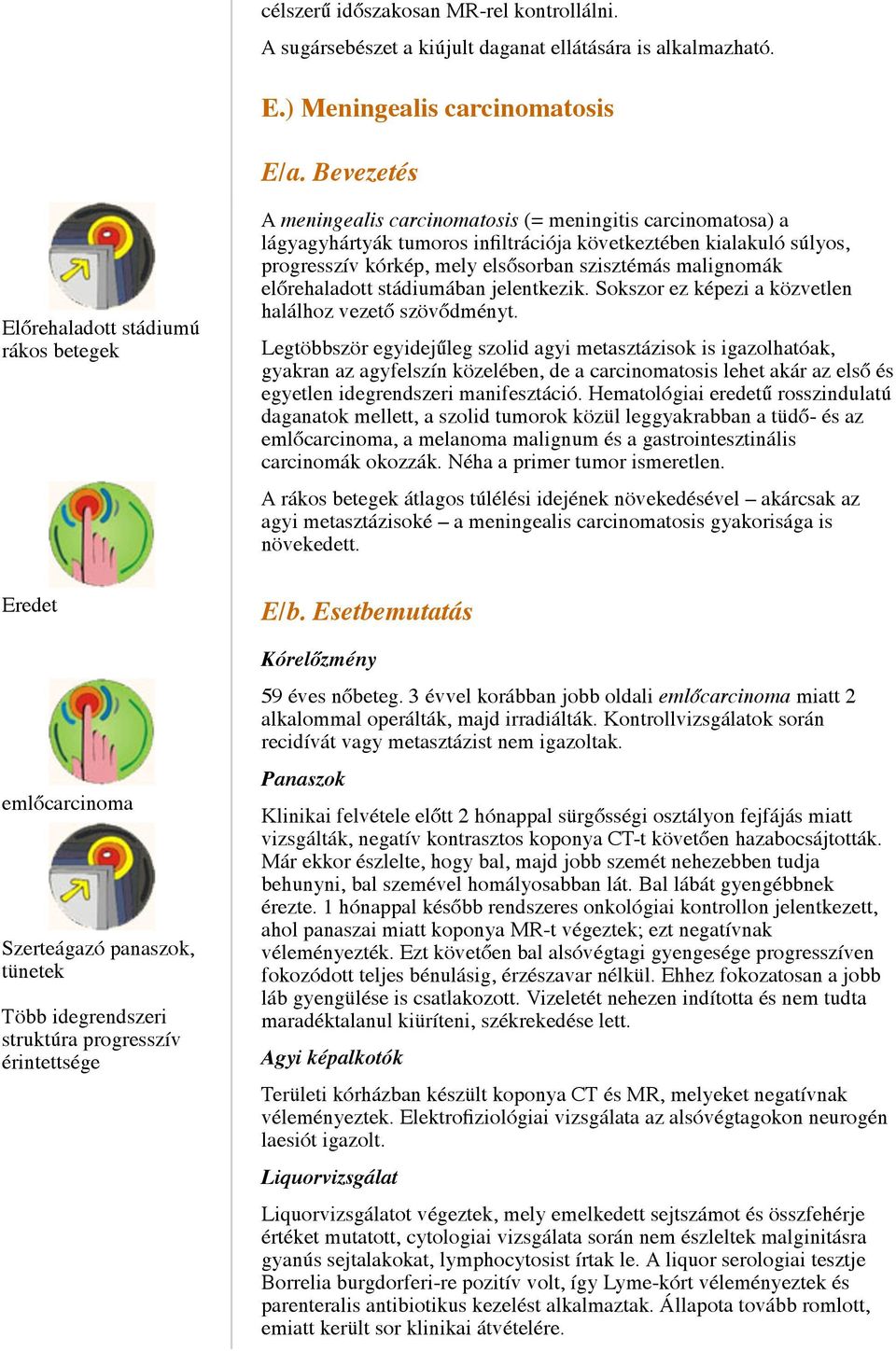 carcinomatosa) a lágyagyhártyák tumoros infiltrációja következtében kialakuló súlyos, progresszív kórkép, mely elsősorban szisztémás malignomák előrehaladott stádiumában jelentkezik.