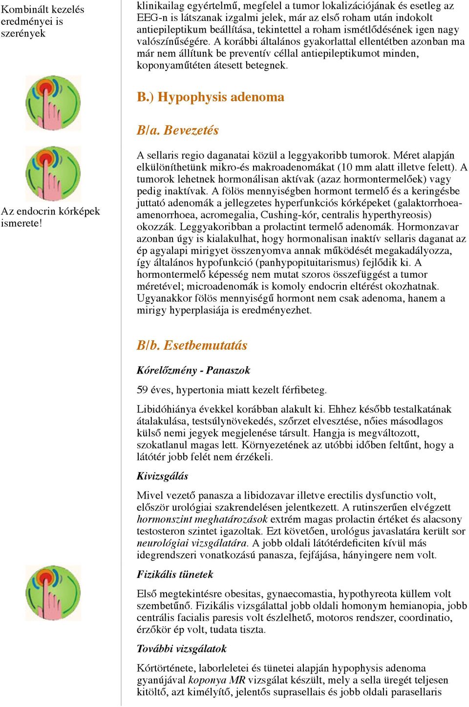 A korábbi általános gyakorlattal ellentétben azonban ma már nem állítunk be preventív céllal antiepileptikumot minden, koponyaműtéten átesett betegnek. B.) Hypophysis adenoma B/a.