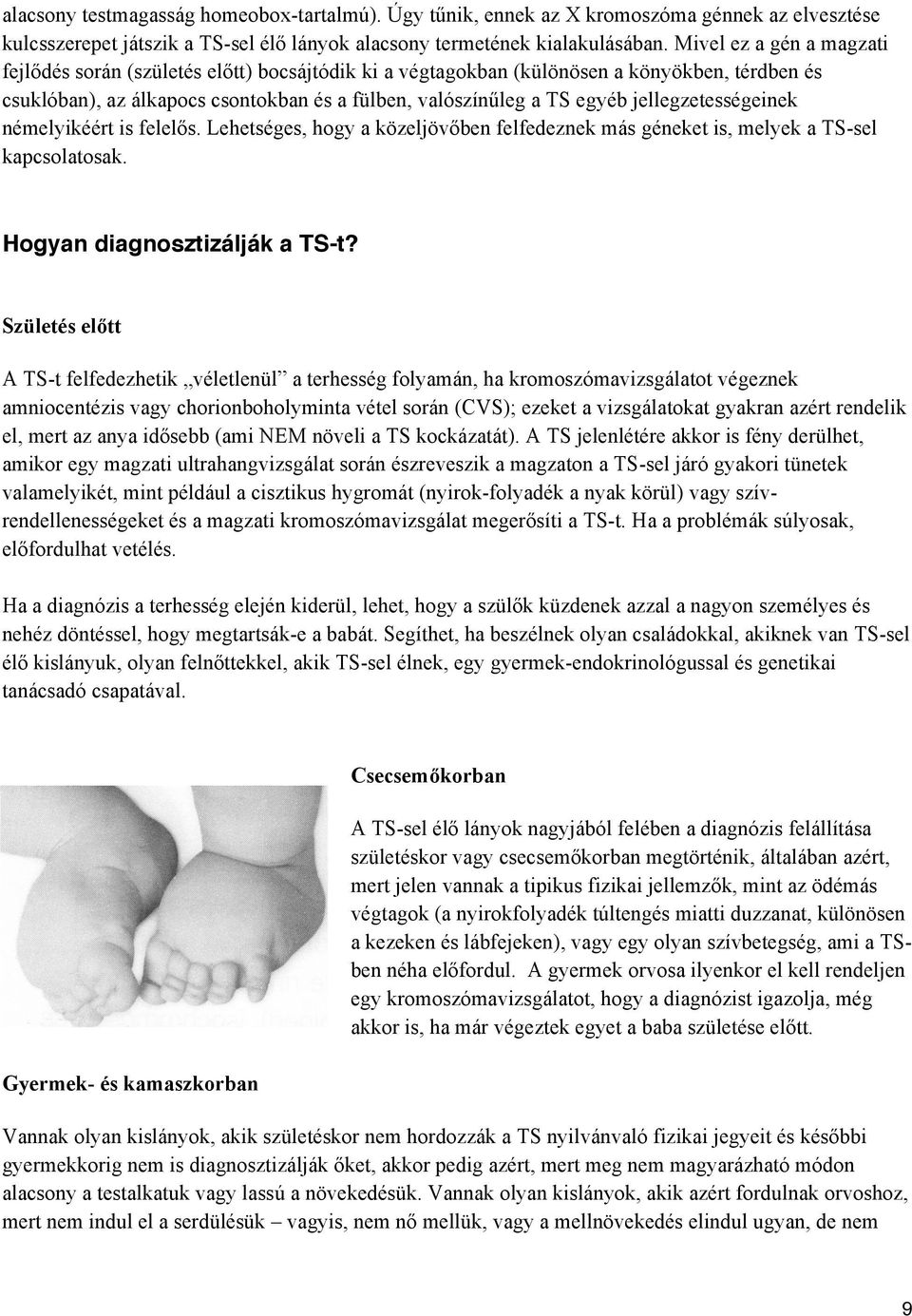 jellegzetességeinek némelyikéért is felelős. Lehetséges, hogy a közeljövőben felfedeznek más géneket is, melyek a TS-sel kapcsolatosak. Hogyan diagnosztizálják a TS-t?