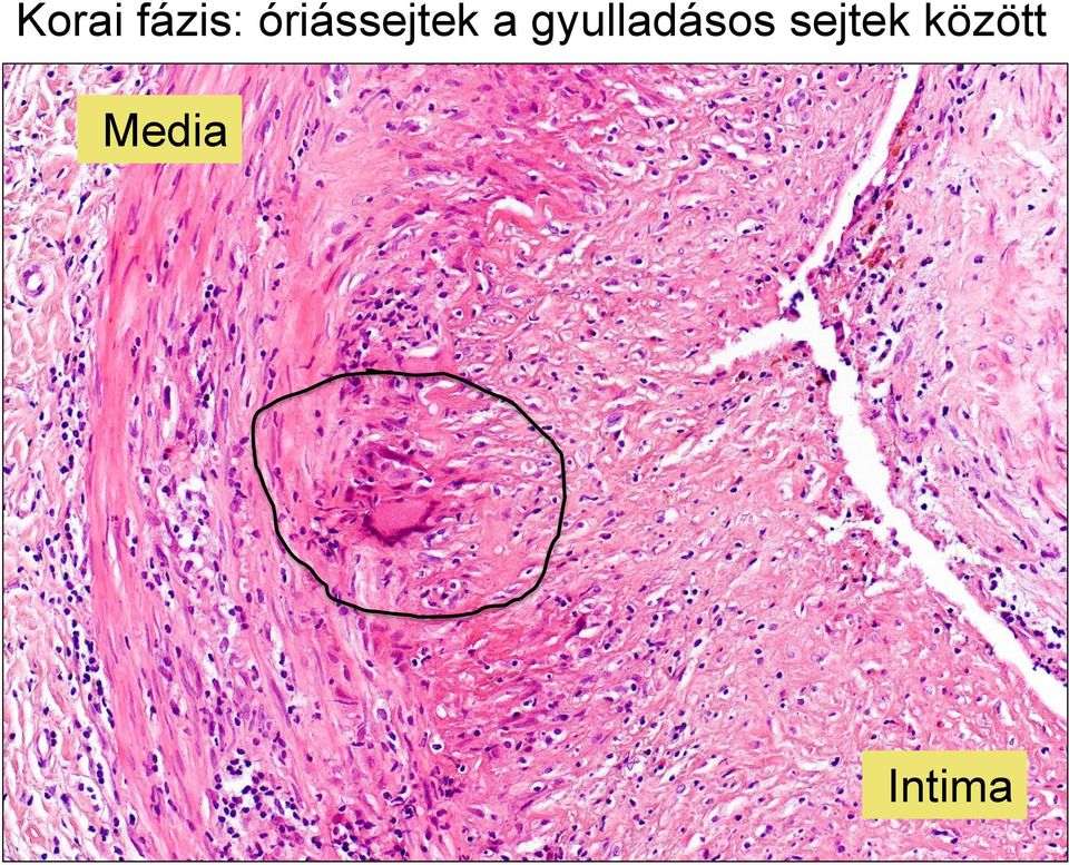 gyulladásos