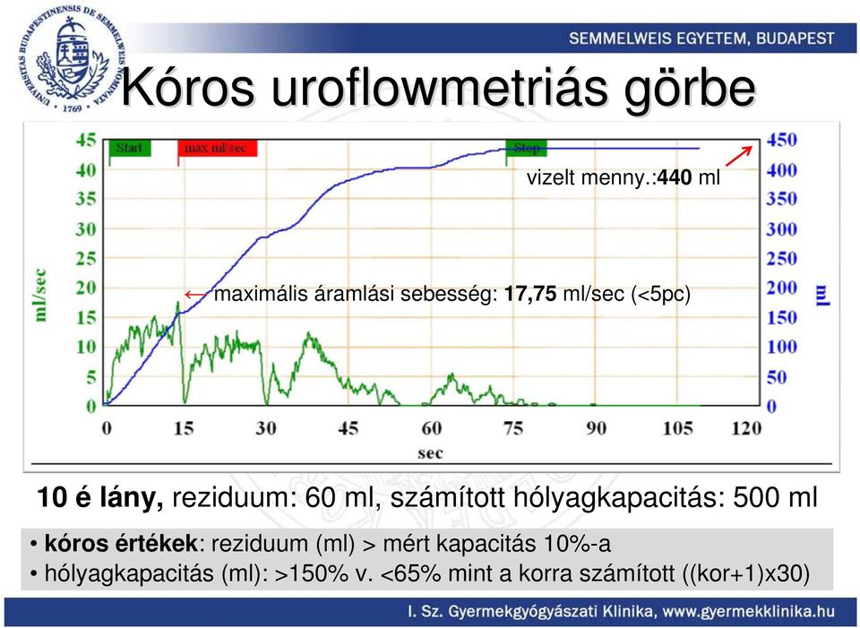 reziduum: 60 ml, számított hólyagkapacitás: 500 ml kóros értékek: