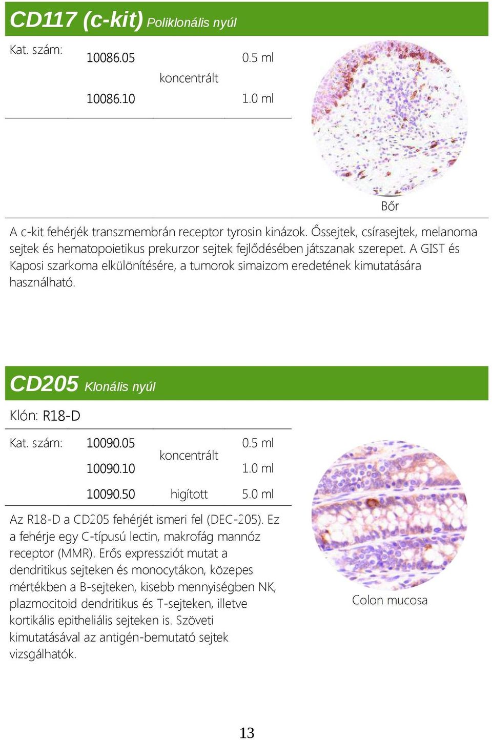 A GIST és Kaposi szarkoma elkülönítésére, a tumorok simaizom eredetének kimutatására használható. Bőr CD205 Klonális nyúl Klón: R18-D Kat. szám: 10090.05 10090.10 1.0 ml 10090.50 higított 5.