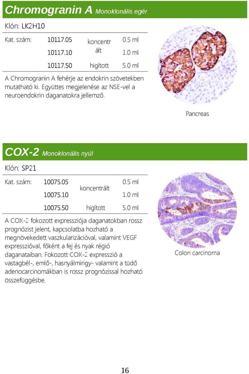 Pancreas COX 2 Monoklonális nyúl Klón: SP21 Kat. szám: 10075.05 10075.10 1.0 ml 10075.50 higított 5.