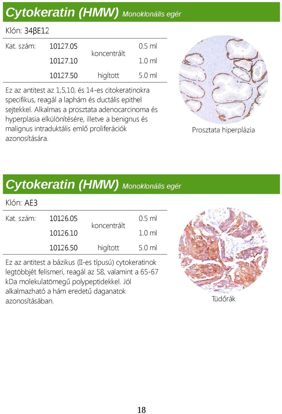 Alkalmas a prosztata adenocarcinoma és hyperplasia elkülönítésére, illetve a benignus és malignus intraduktális emlő proliferációk azonosítására.