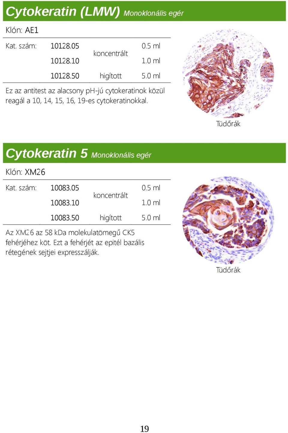 Tüdőrák Cytokeratin 5 Monoklonális egér Klón: XM26 Kat. szám: 10083.05 10083.10 1.0 ml 10083.50 higított 5.