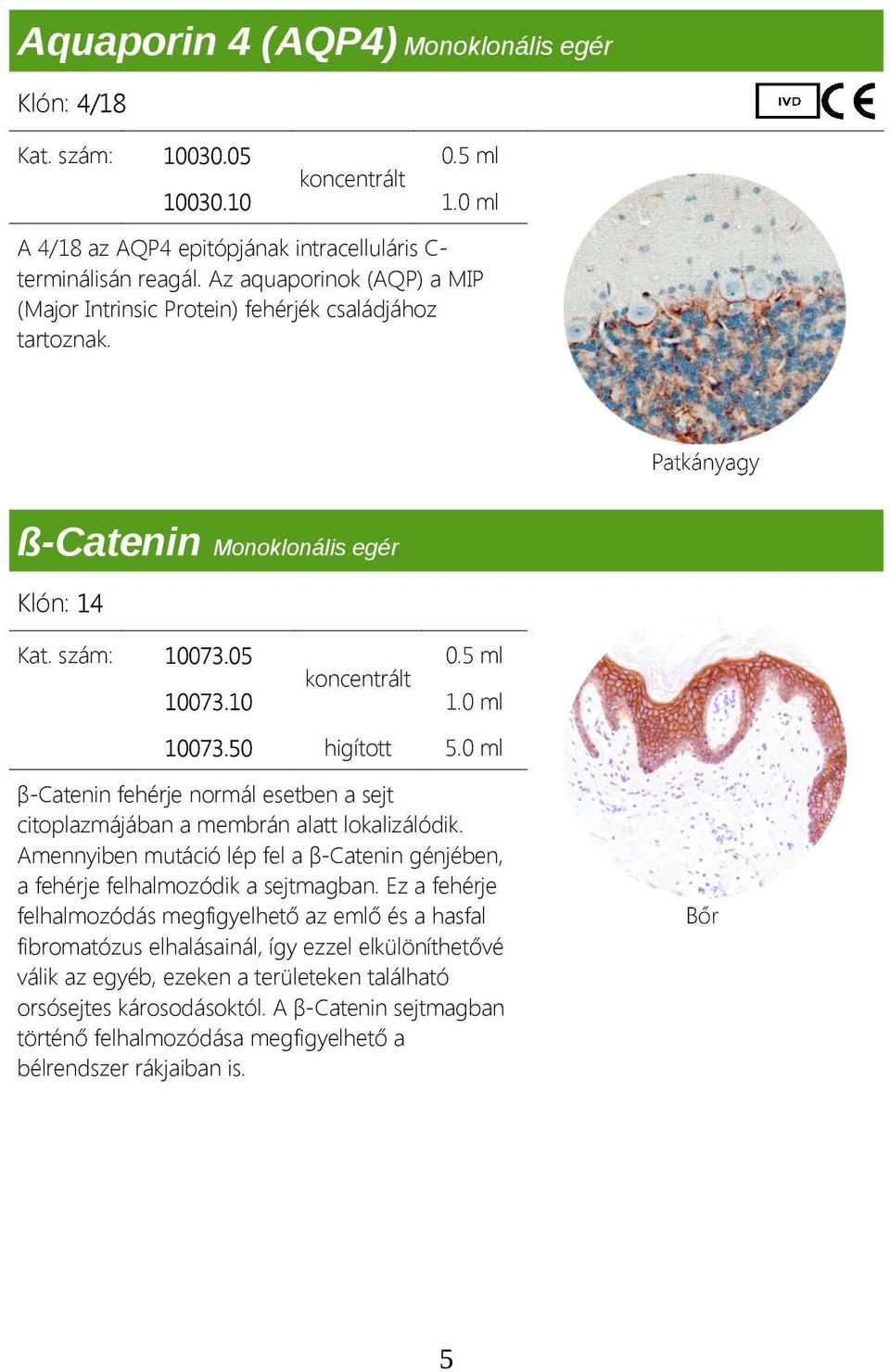 0 ml β-catenin fehérje normál esetben a sejt citoplazmájában a membrán alatt lokalizálódik. Amennyiben mutáció lép fel a β-catenin génjében, a fehérje felhalmozódik a sejtmagban.