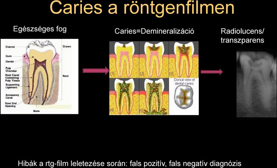 transzparens Hibák a rtg-film