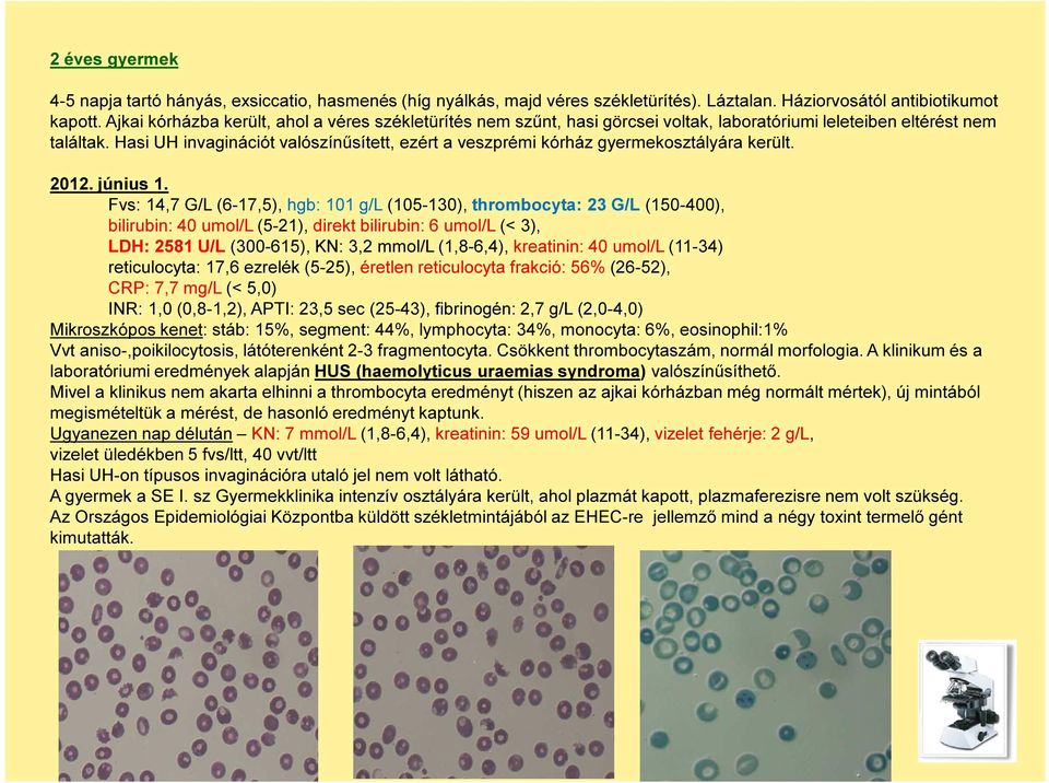 Hasi UH invaginációt valószínűsített, ezért a veszprémi kórház gyermekosztályára került. 2012. június 1.