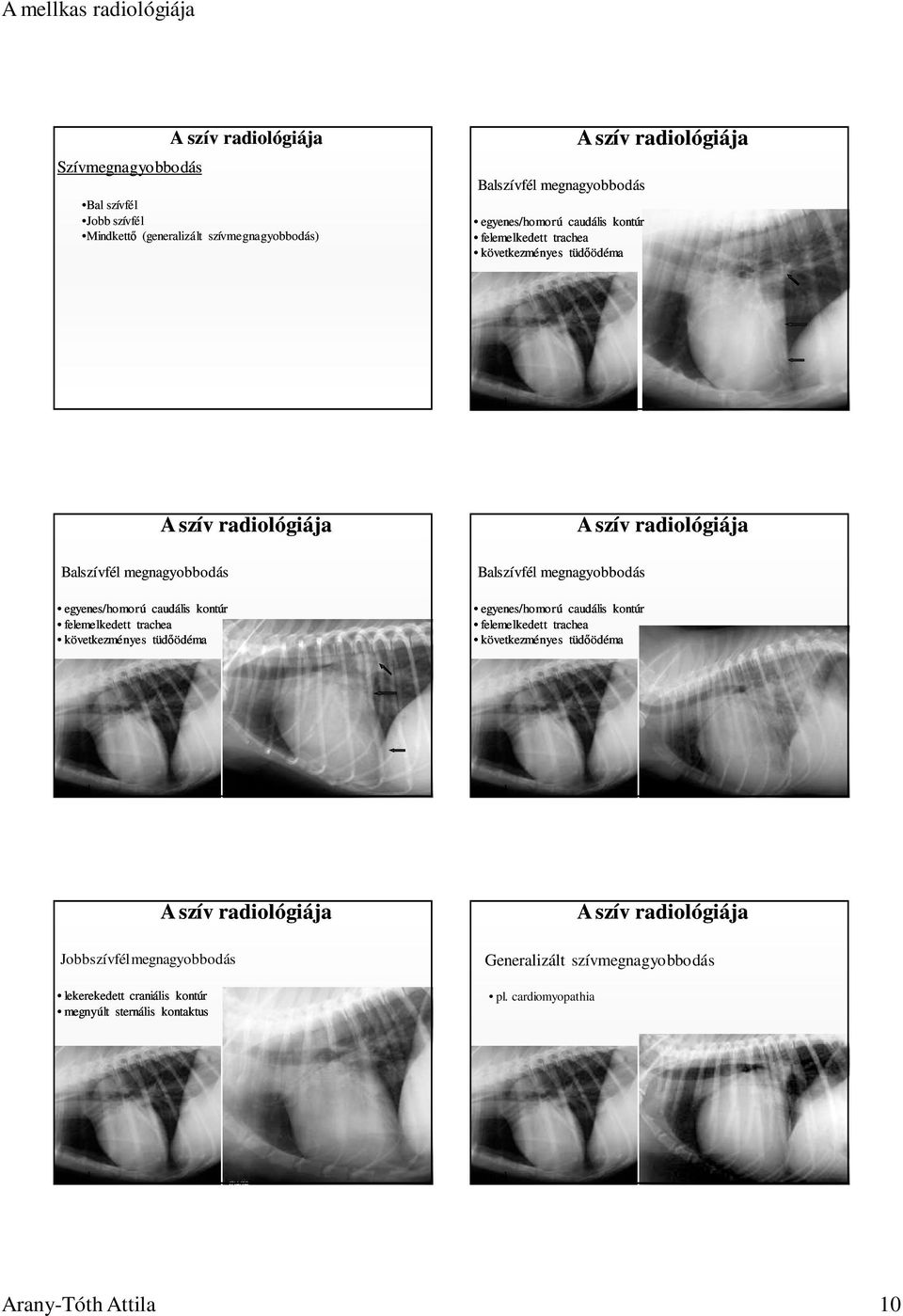 tüdıödéma Balszívfél megnagyobbodás egyenes/homorú caudális kontúr felemelkedett trachea következményes tüdıödéma normal normal Jobbszívfél