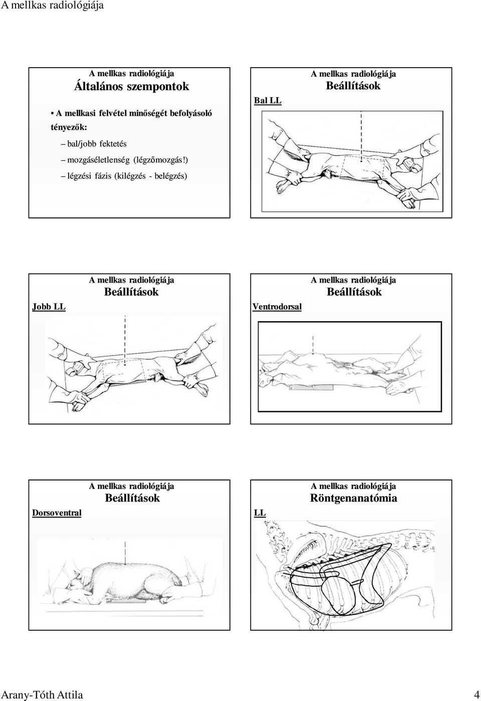 ) légzési fázis (kilégzés - belégzés) Bal LL Beállítások Jobb LL