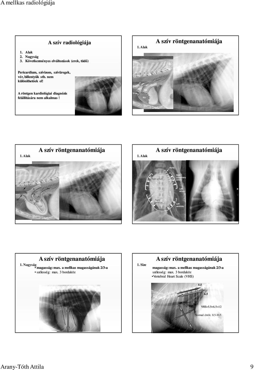 Alak A szív röntgenanatómiája A szív röntgenanatómiája 1. Nagyság magasság: max. a mellkas magasságának 2/3-a szélesség: max. 3 bordaköz 1.