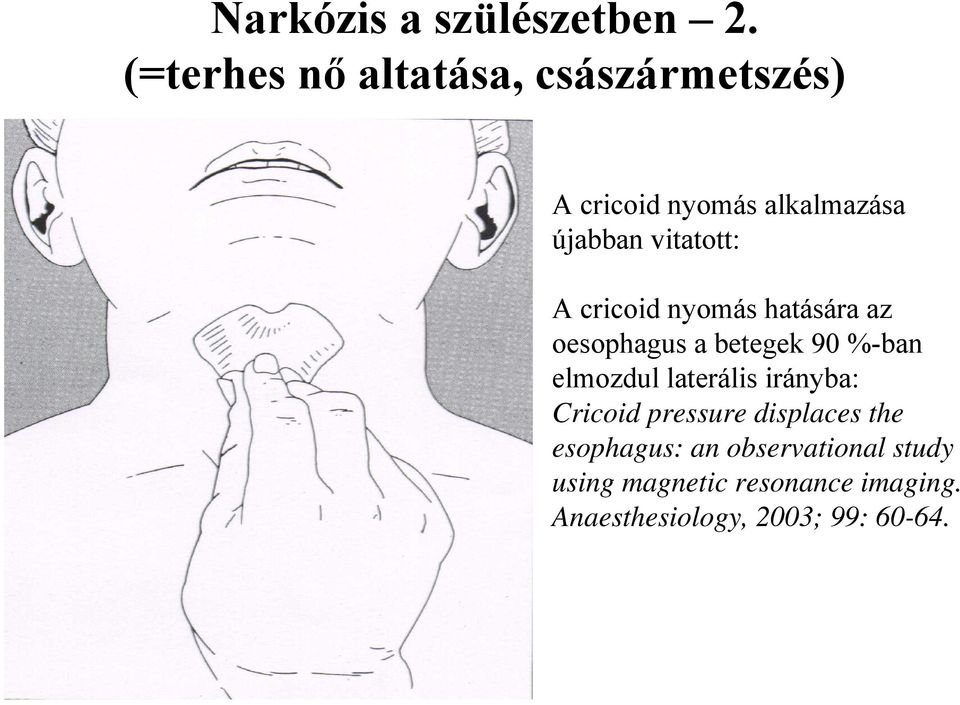 vitatott: A cricoid nyomás hatására az oesophagus a betegek 90 %-ban elmozdul