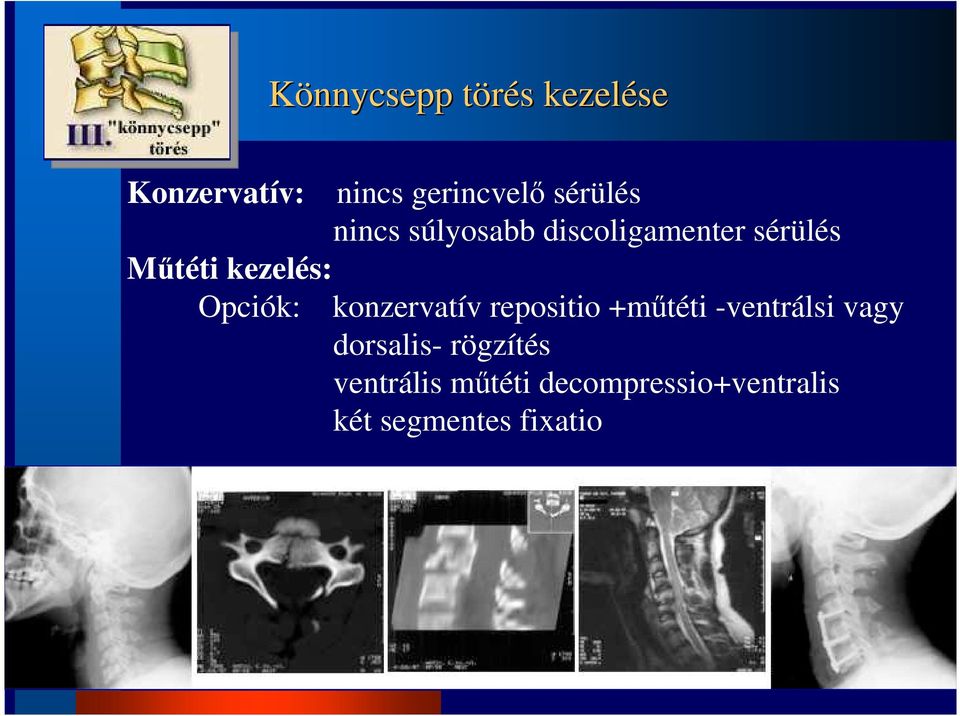 Opciók: konzervatív repositio +mőtéti -ventrálsi vagy dorsalis-