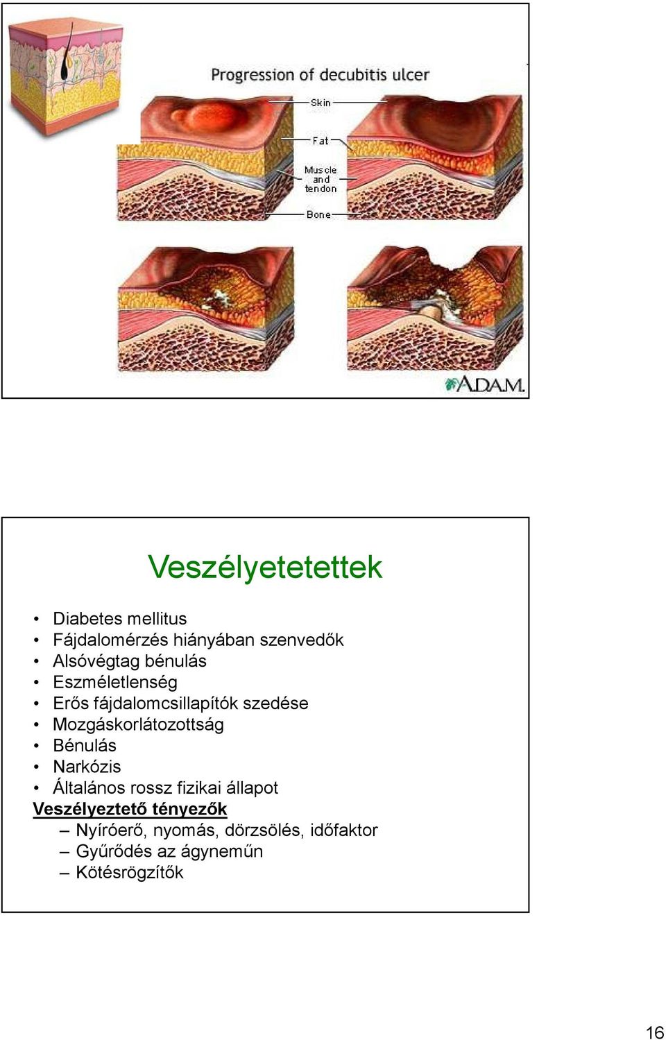 Mozgáskorlátozottság Bénulás Narkózis Általános rossz fizikai állapot