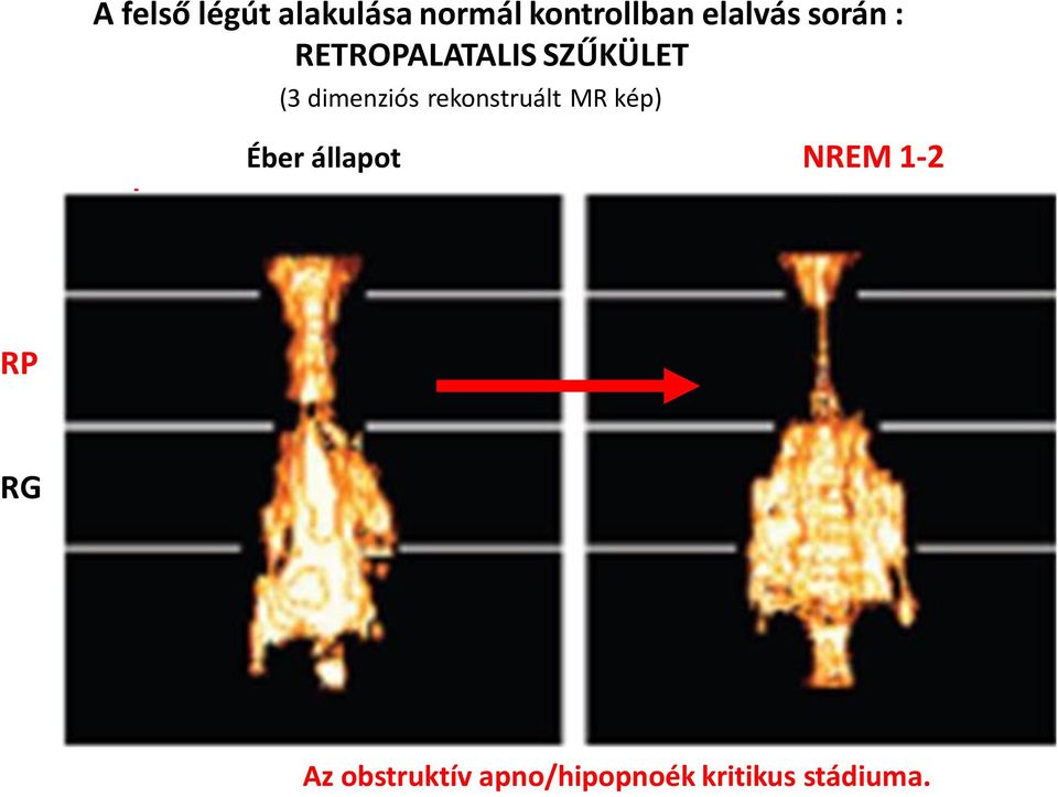 dimenziós rekonstruált MR kép) st.