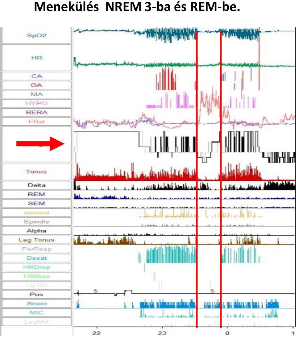 és REM-be.