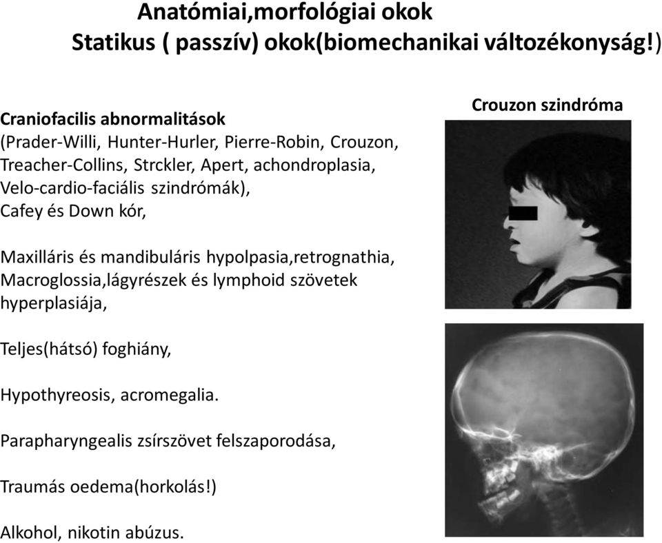 Velo-cardio-faciális szindrómák), Cafey és Down kór, Crouzon szindróma Maxilláris és mandibuláris hypolpasia,retrognathia,