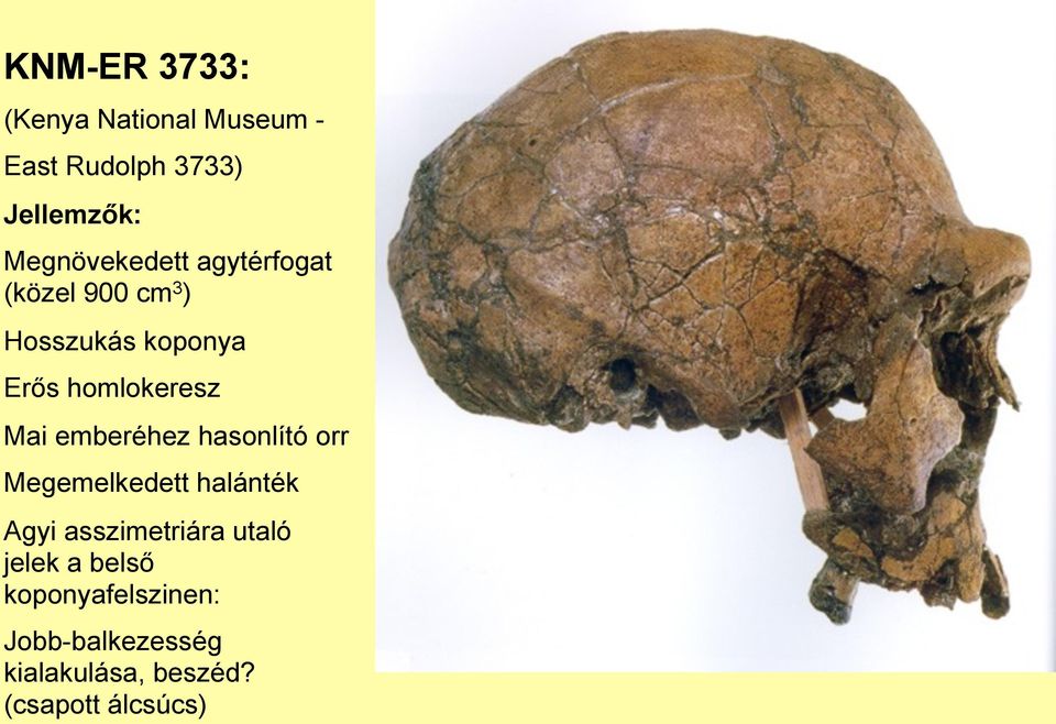 homlokeresz Mai emberéhez hasonlító orr Megemelkedett halánték Agyi