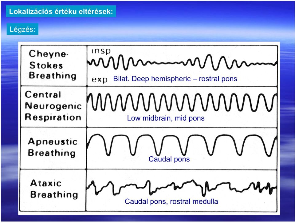 Deep hemispheric rostral pons Low