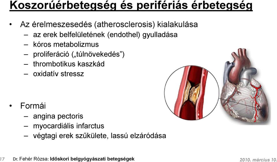 túlnövekedés ) thrombotikus kaszkád oxidatív stressz Formái angina pectoris myocardiális