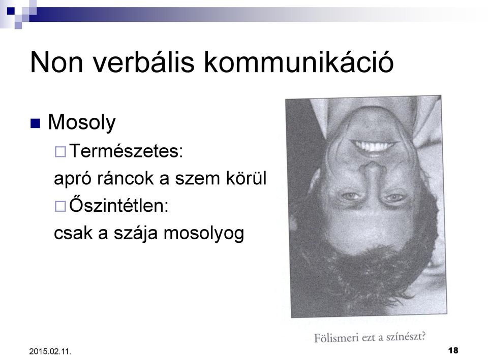 ráncok a szem körül