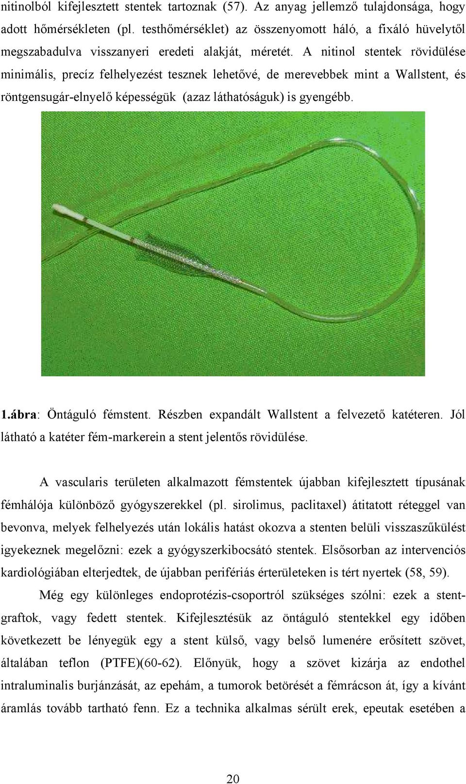 A nitinol stentek rövidülése minimális, precíz felhelyezést tesznek lehetővé, de merevebbek mint a Wallstent, és röntgensugár-elnyelő képességük (azaz láthatóságuk) is gyengébb. 1.